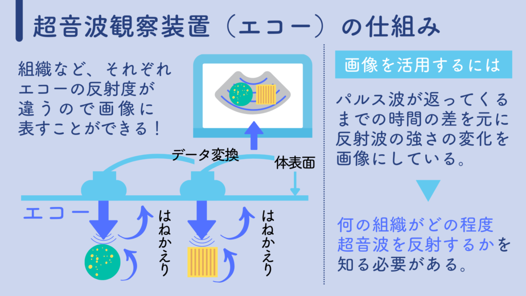 超音波観察装置（エコー）の仕組み